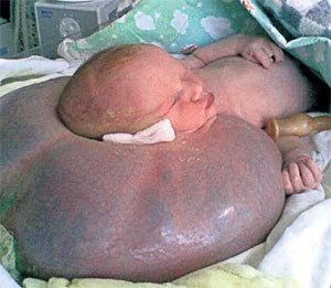 Гошу спасли от тяжелой ноши