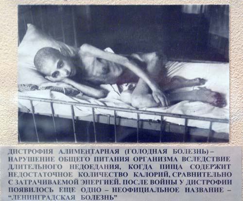Люди превращались в живых скелетов. wikimedia