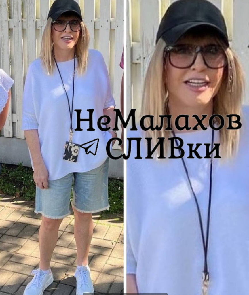 Застывшая улыбка: Пугачеву с натянутым лицом не узнать