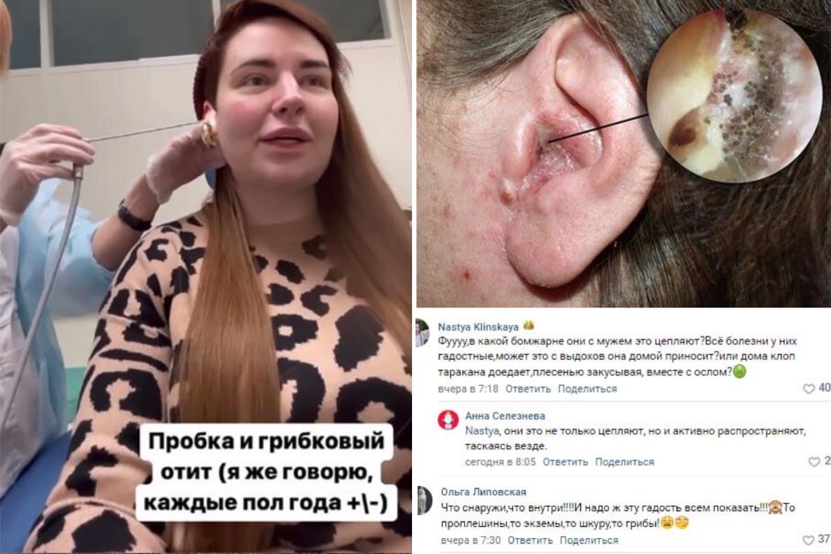 В какой бомжарне они это цепляют: Саша Черно из «Дома-2» показала крупным планом грибковую инфекцию в интимном месте