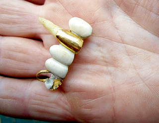 Одну из Машиных коронок ее сестра нашла под кроватью