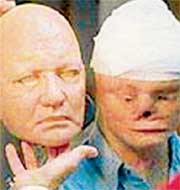 МАСКА: пока трансплантация лица не стала реальностью, изуродованным пациентам предлагают носить вот такие протезы